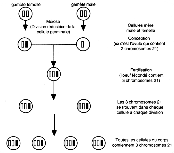 Distribution anormale du chromosome 21 Distribution anormale du chromosome 21